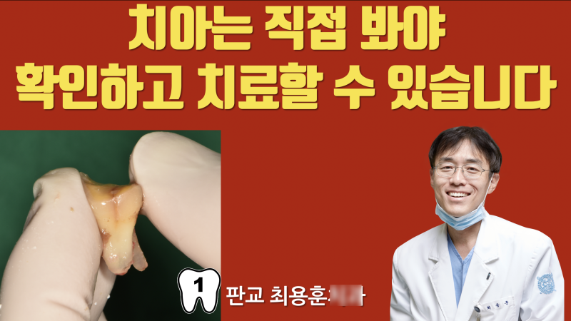 치아 상태는 직접 보는 수 밖에 없습니다