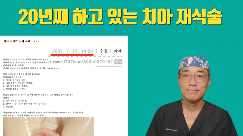20년전부터 하고 있는 치아재식술 #재식술 #치아재식술 #의도적재식술