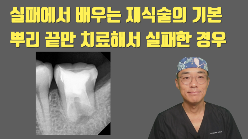 [솔직 고백] 재식술 이렇게 해서 실패했습니다 #재식술 #치아재식술 #최용훈원장