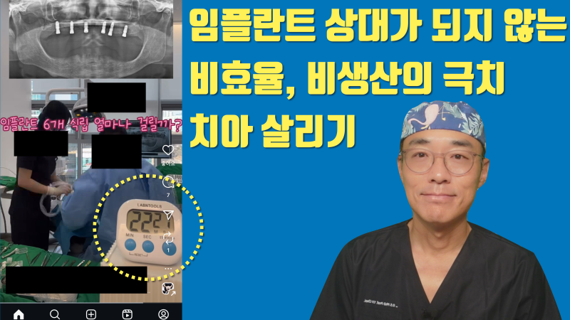 [현타 하소연] 임플란트 6개 심는게 치아 하나 살리는 것보다 더 빠릅니다 이게 현실입니다 #재식술 #치아재식술 #치아살리기