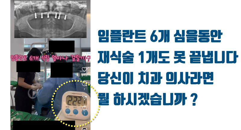 [현타 하소연] 임플란트 6개 심는게 치아 하나 살리는 것보다 더 빠릅니다 이게 현실입니다 #재식술 #치아재식술 #치아살리기