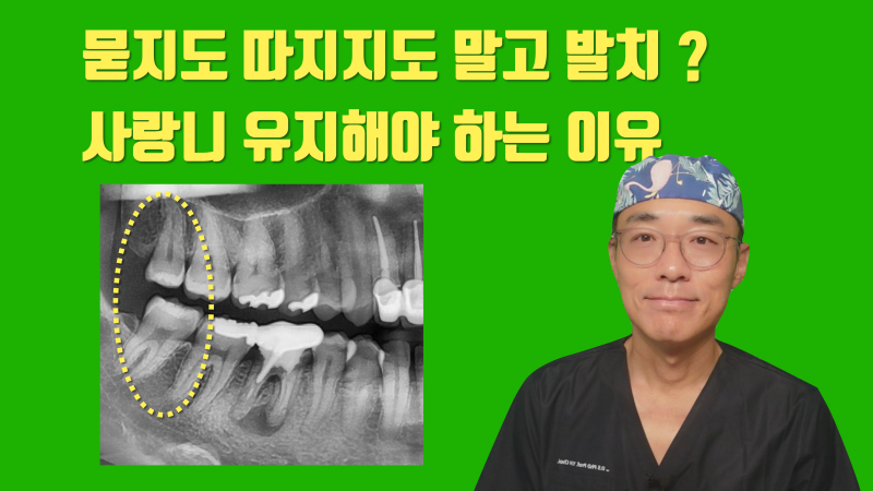 [외로운 외침] 멀쩡한 사랑니는 유지하라고 권유하는 이유 #재식술 #치아이식 #최용훈원장