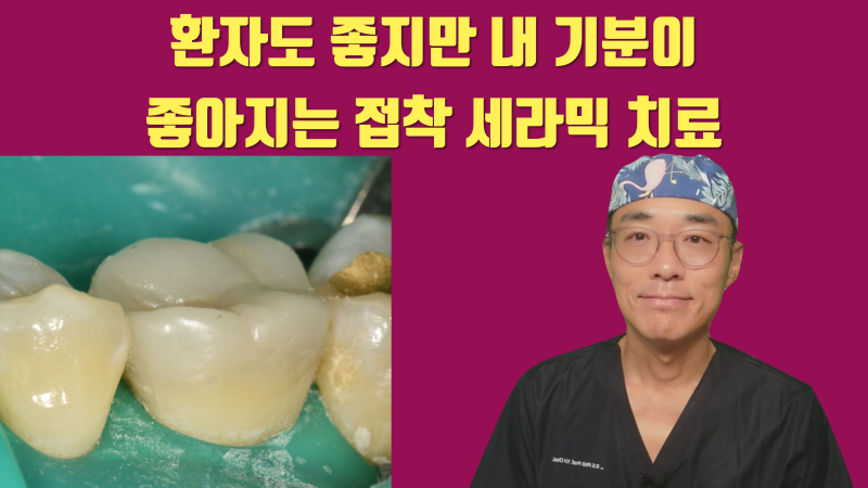 [기분이가 좋은 접착 세라믹] 환자도 중요하지만 치과 의사인 '내'가 더 중요한 치료 #접착세라믹 #치아살리기 #최용훈원장
