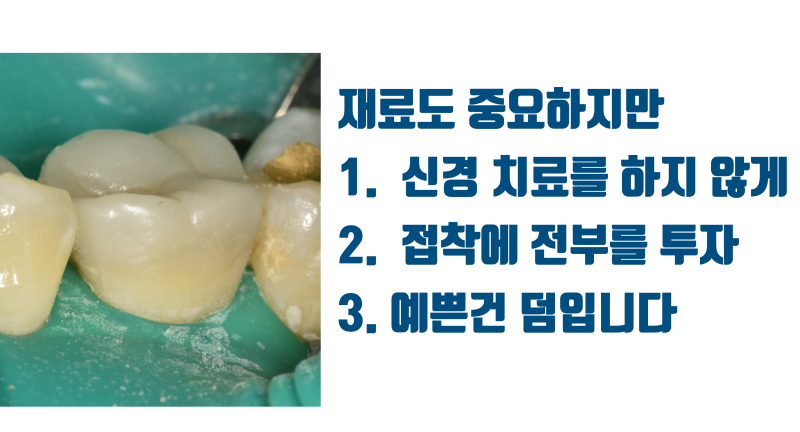 [기분이가 좋은 접착 세라믹] 환자도 중요하지만 치과 의사인 '내'가 더 중요한 치료 #접착세라믹 #치아살리기 #최용훈원장