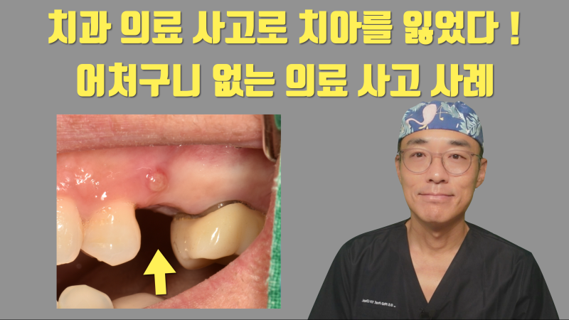 [최악의 치과 의료 사고] 판단 착오로 멀쩡한 치아를 발치한 사례 #재식술 #치아살리기 #최용훈원장