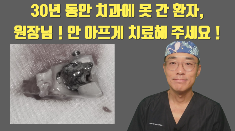 [치과 고통 공포증의 해결] 치과가 무서워서 30년동안 치과에 가지 못한 환자 #재식술 #치아재식술 #최용훈원장