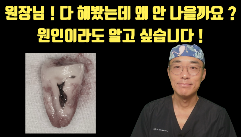 [치아의 숨겨진 비밀] 환자도 치과 의사도 고생 + 골탕만 먹는 이유 #재식술 #치아재식술 #최용훈원장
