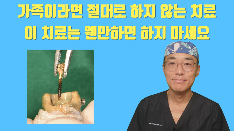 [구독자만 알고 계세요] 주조 포스트(casting post)는 될 수 있으면 안하시는게 좋습니다 #재식술 #최용훈원장