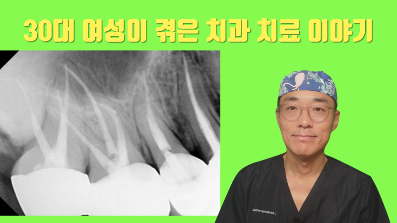 [놀람 주의] 치과 의사의 재능(?)이 30대 여성에게 미치는 영향 #치아살리기 #최용훈원장