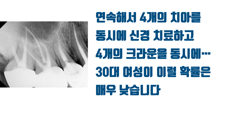 [놀람 주의] 치과 의사의 재능(?)이 30대 여성에게 미치는 영향 #치아살리기 #최용훈원장