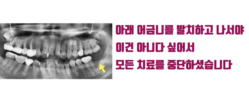 [놀람 주의] 치과 의사의 재능(?)이 30대 여성에게 미치는 영향 #치아살리기 #최용훈원장 사진 3