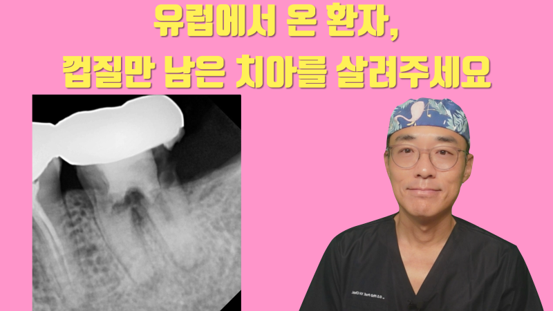 [해외 환자 재식술] 유럽에서 찾아온 환자, 시도라도 해 주세요 #재식술 #치아재식술 #최용훈원장