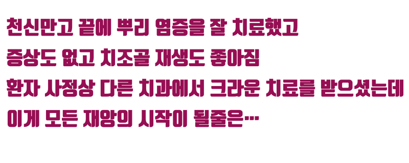 [화가 나는 증례] 애써 살려놓은 치아가 크라운 실패로 결국 발치하게 된 증례 #재식술 #치아살리기 #최용훈원장 사진 4