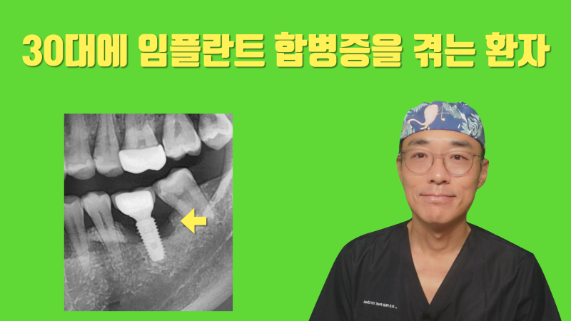 [임플란트 유감] 임플란트가 틀렸다 잘못되었다가 아닙니다 수많은 기회를 버린 환자가 안타까워서 포스팅합니다 #재식술 #치아살리기 #최용훈원장
