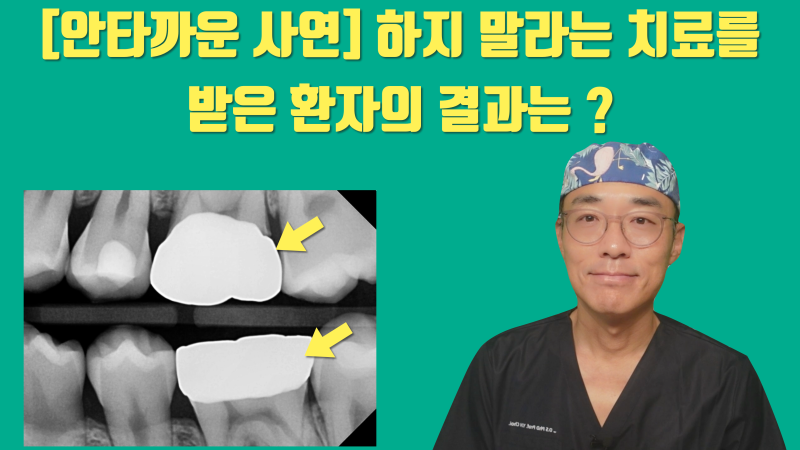 [안타까운 환자 이야기] 하지 말라고 한 치료를 받은 환자가 겪고 있는 고통 #치아살리기 #최용훈원장