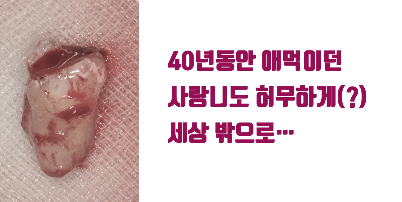 [오랜 숙원의 해결] 이 방법을 알았다면 40년을 고생하지는 않았을 건데... #재식술 #치아살리기 #최용훈원장 사진 4