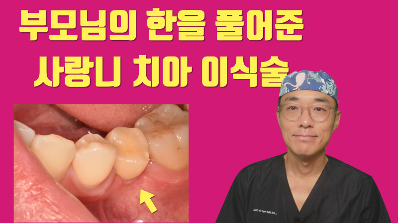 [부모님의 선물] 선천적으로 영구치가 없는 자리에 사랑니 이식으로 새 자연 치아가 생겼다 ~! #치아이식 #사랑니이식 #최용훈원장