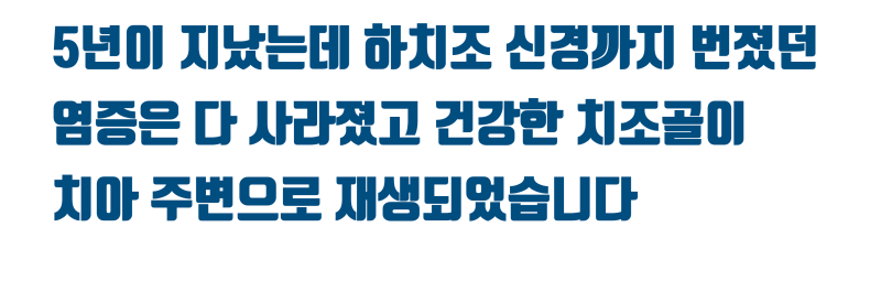 [할거면 제대로, 치근단 수술] 신경관까지 번진 염증의 치근단수술(치근절제술) 해결 5년 증례 #치근단수술 #치근절제술 #최용훈원장 사진 5