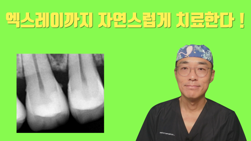 [엑스레이까지 자연스럽게] 설명들 듣고 봐야 이해되는 신경 치료 없이 자연스러운 부분 세라믹 치료 #세라믹치료 #치아살리기 #최용훈원장