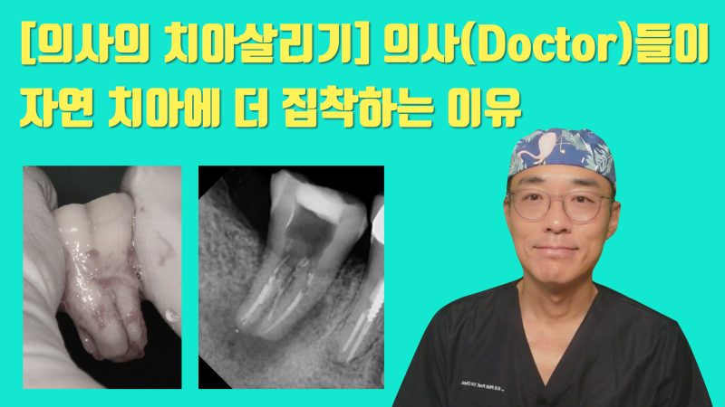[의사의 치아살리기] 의사(Doctor)들이 더 자연 치아를 살리고 싶어 하는 이유에 대해서 #재식술 #치아재식술 #최용훈원장