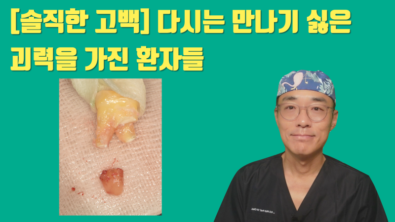[누구의 책임일까 ?] 크렉과 파절은 환자 본인 스스로 발생시킵니다 #재식술 #치아살리기 #최용훈원장
