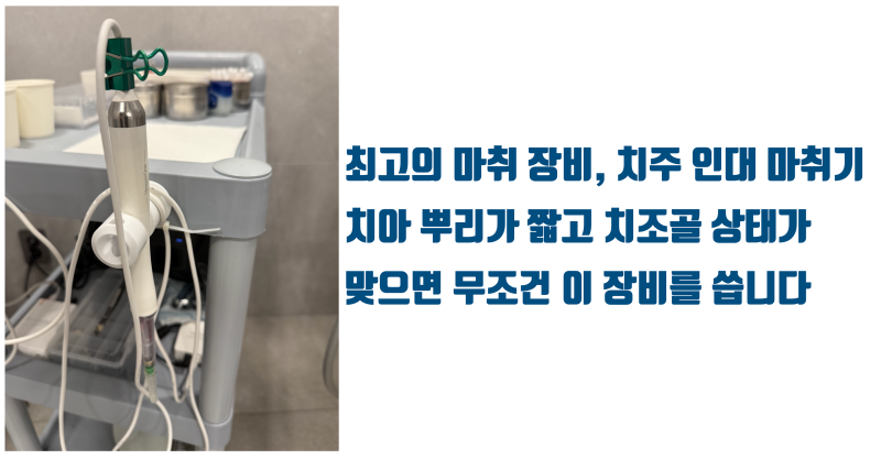 [치과 마취의 신세계] 이 마취 장비로  마취 받을 수 있으면 당신은 행운아 ! #치과무통마취 #치아살리기 #최용훈원장