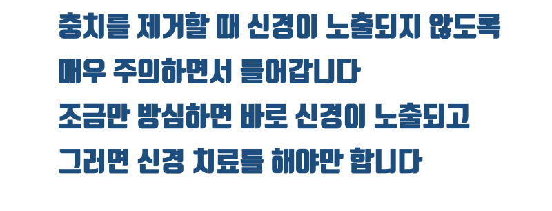 [신경 치료 안하게] 전기 화학적 치료 + 신경 보호 전용 재료로 깊은 충치를 신경 치료 안하도록 하는 방법 #최소삭제 #치아살리기 #최용훈원장 사진 4