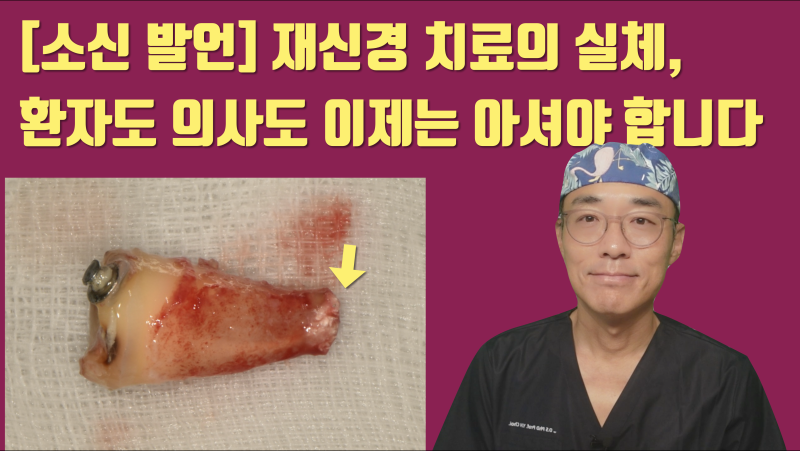 환자도 의사도 잘 모르는 재신경 치료의 실체에 대해 솔직하게 알아봅시다 #치아살리기 #최용훈원장
