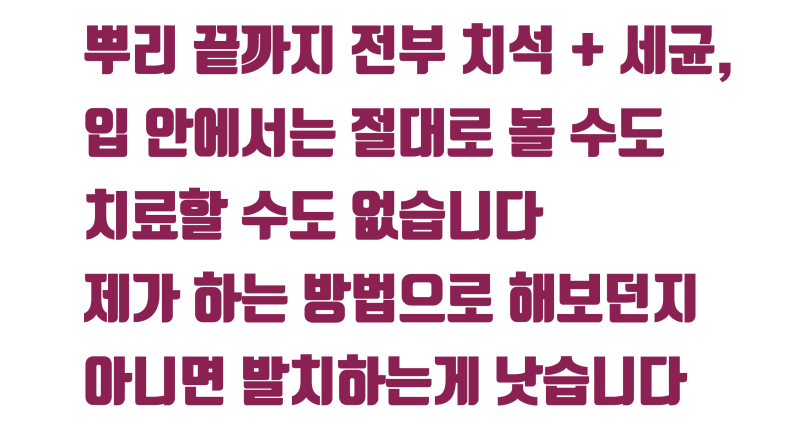 [역사적인 치아 살리기] 치석과 세균으로 발치 판정 받은 치아를 살리는 과정 #재식술 #치아살리기 #최용훈원장