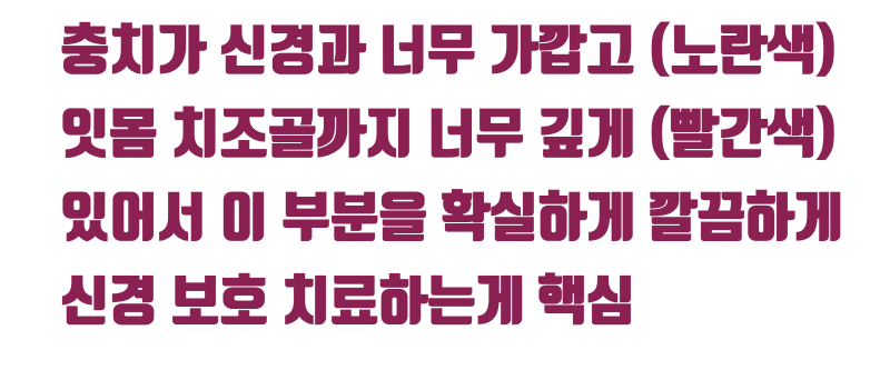 [나는 신경 치료가 싫어요] 지방에서 신경 치료 안하려고 오는 환자 #치아살리기 #최용훈원장