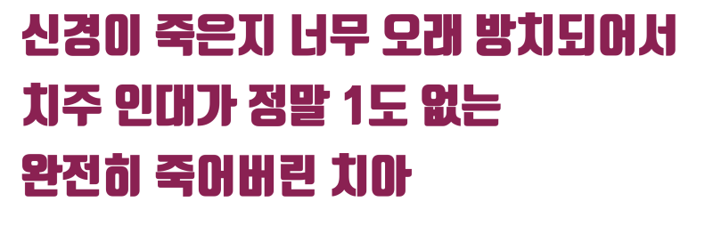 [역사적인 치아 살리기] 앞니는 어떻게든 살려볼 기회가 많습니다 #치주질환재식술 #재식술 #최용훈원장 사진 3