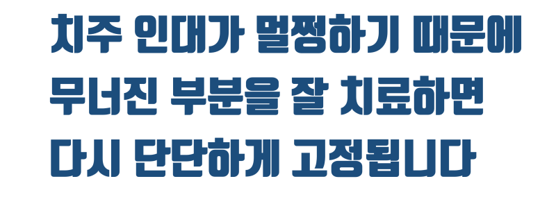 [하고 나서 놀란 치료] 신이시여 제가 이 치아를 안 부서지게 뽑았습니까 ? #재식술 #치아살리기 #최용훈원장 사진 5