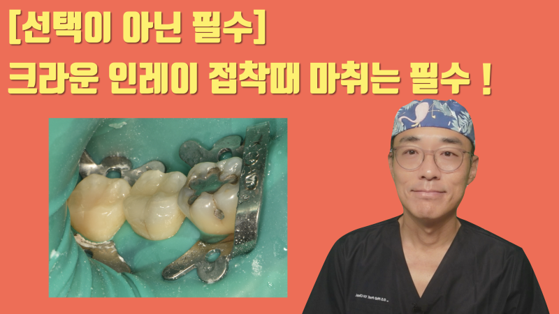 [치과 마취는 선택이 아닌 필수] 조금이라도 아픈게 예상되면 반드시 마취를 해야 하는 이유 #무통마취 #치아살리기 #최용훈원장