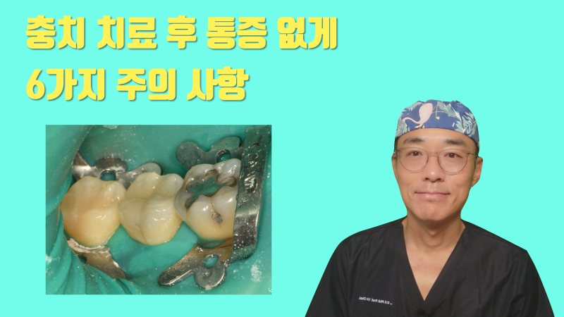 [통증 예방] 치과 충치 치료 후 통증 줄이는 방법 6가지 #세라믹치료 #치아살리기 #최용훈원장