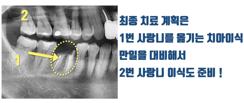 치과에서 부모님께 감사하다고, 사랑한다고 말하라고 하는 이유 #재식술 #최용훈원장 사진 3