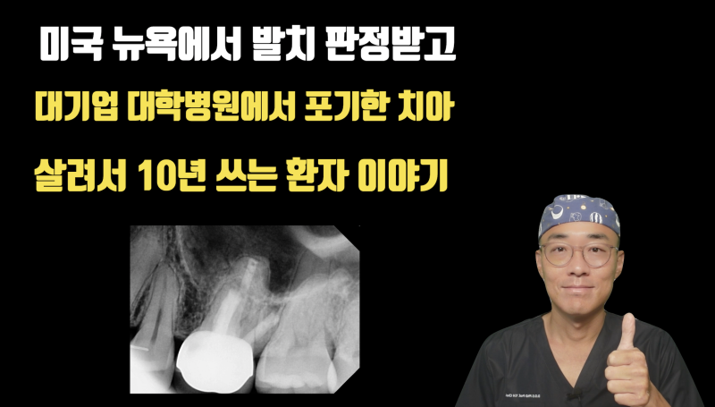 미국 뉴욕 -> 서울 강남 -> 분당에서 살린 치아 10년 증례 소개 #재식술 #최용훈원장 #치아살리기
