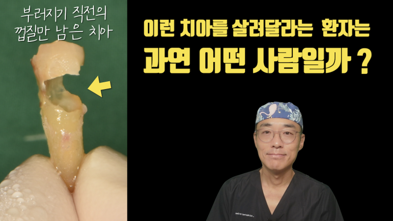[마지막 잎새, 마지막 치아] 누군가에게는 생명이 달린 치아 이야기 #재식술 #치아살리기 #최용훈원장