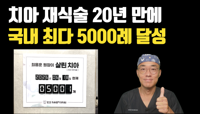치아재식술 국내 최다 증례 5000례 달성 기념 치아재식술의 모든것 #치아재식술 #최용훈원장