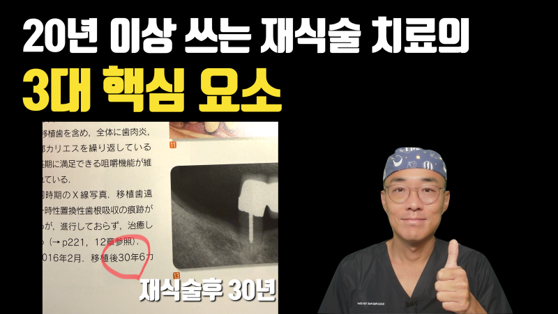 3 Key Success Factors for Long-Lasting Tooth Replantation | Intentional Replantation | Dr. Yong-Hoon Choi