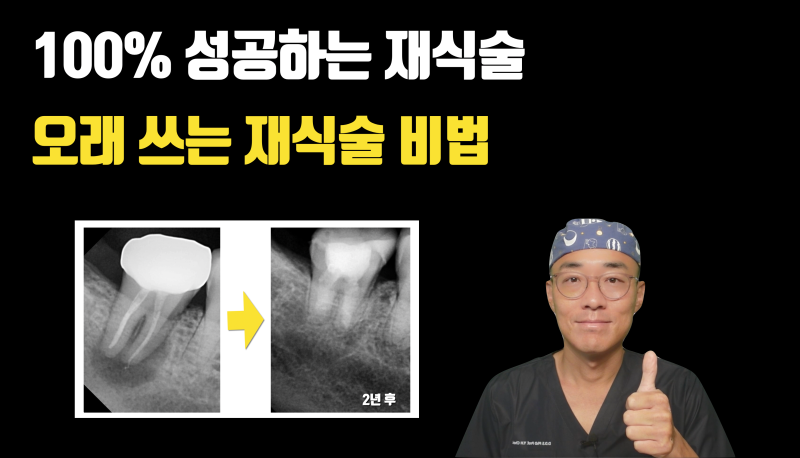 실패 없는 재식술, 오래 가는 재식술 #치아재식술 #최용훈원장 #의도적재식술